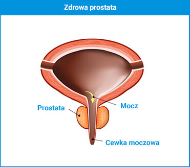 zdrowa prostata