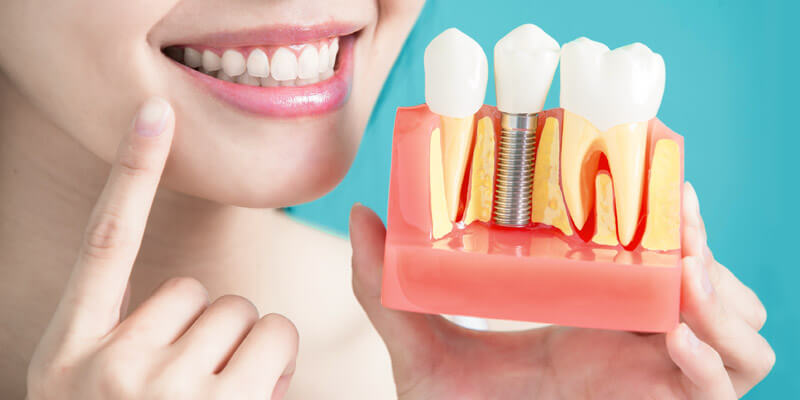 Metody odbudowy utraconego zęba