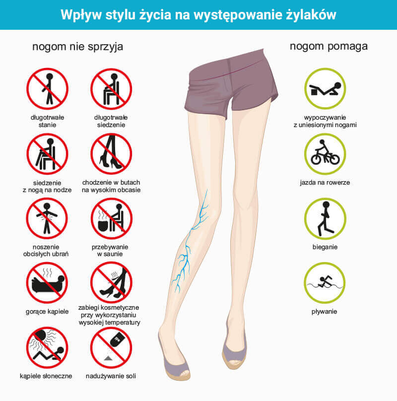 co wpływa na żylaki